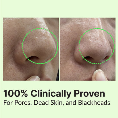 RETURNU Pore Shooter Gommage Cleansing Balm